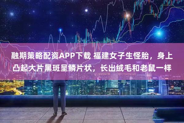 融期策略配资APP下载 福建女子生怪胎，身上凸起大片黑斑呈鳞片状，长出绒毛和老鼠一样
